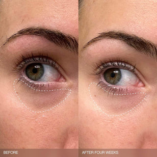 Set iluminador Faded para la decoloración en rostro y cuerpo - Topicals