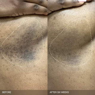 Set iluminador Faded para la decoloración en rostro y cuerpo - Topicals