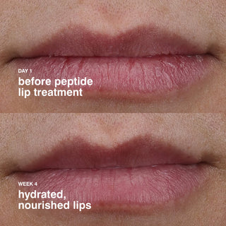 Labial Peptide Lip treatment - Rhode