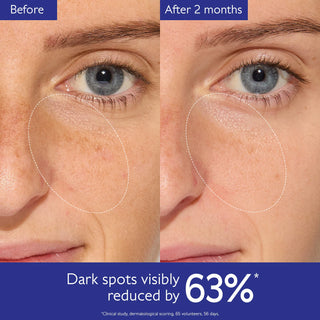 Set Vinoperfect Brightening Routine Anti manchas - Caudalie