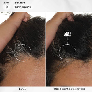 FutureIQ™ Sérum para la longevidad del cabello - K18