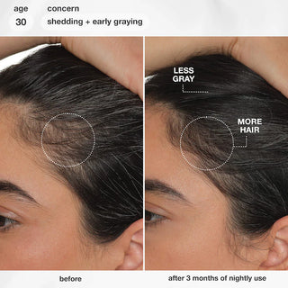 FutureIQ™ Sérum para la longevidad del cabello - K18