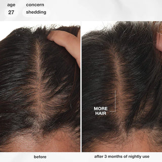 FutureIQ™ Sérum para la longevidad del cabello - K18