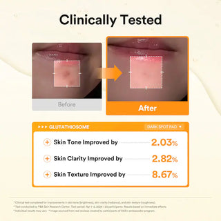 Glutathiosome Vitamin C toner pad: cuidado de las manchas oscuras y piel radiante - Abib